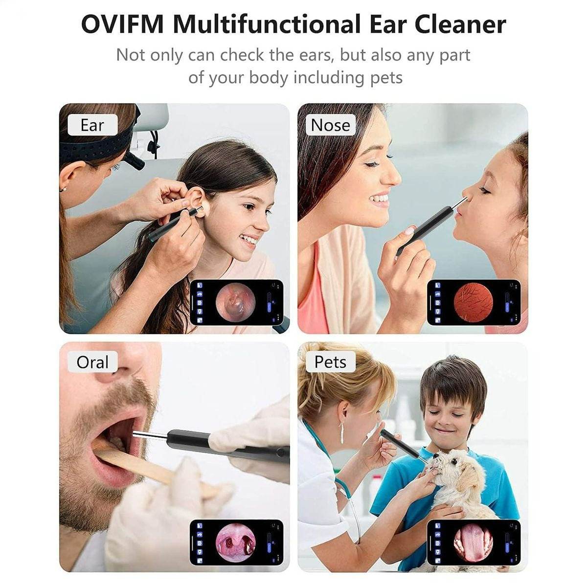 Earwax Remover With Camera - DMC Wholesale
