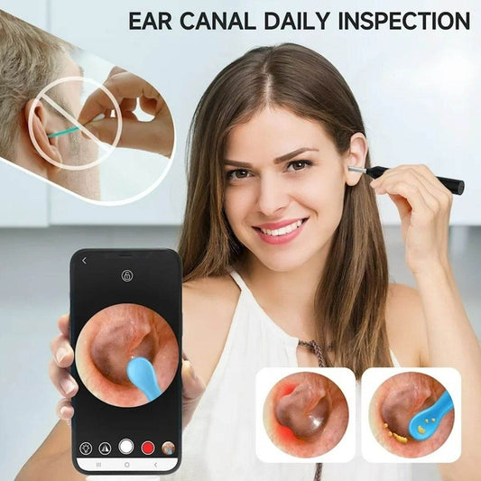 Earwax Remover With Camera - DMC Wholesale